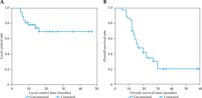 A retrospective study on unresectable or inoperable head and neck cancers treated with stereotactic ablative brachytherapy.