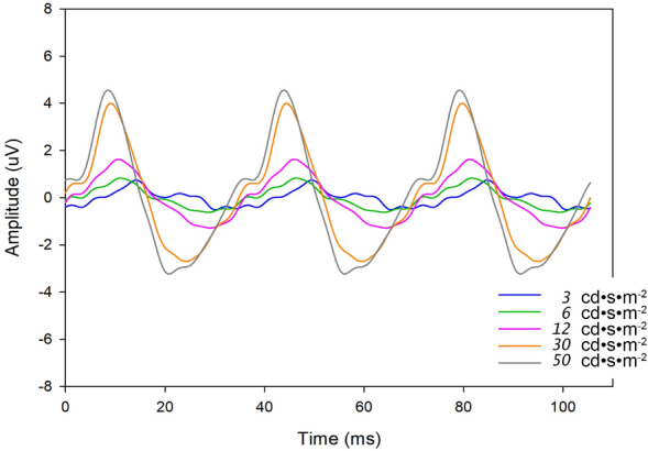 Flicker electroretinogram in newborn infants.