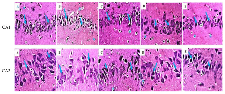 Andrographis paniculata protects against brain hippocampus and cerebellum from mercury chloride induced damage by attenuating oxidative stress.