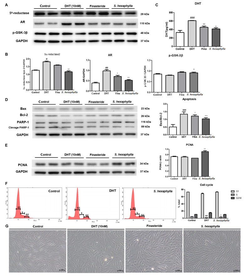 <i>Stauntonia hexaphylla</i> Extract Ameliorates Androgenic Alopecia by Inhibiting Androgen Signaling in Testosterone-induced Alopecia Mice.