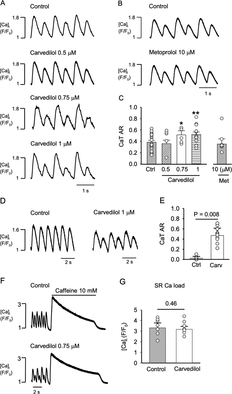 Mechanism of carvedilol induced action potential and calcium alternans.