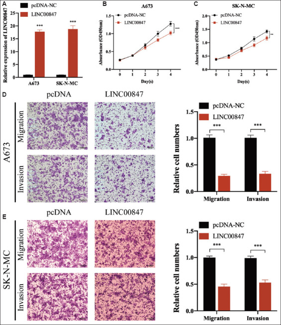 Bone marrow mesenchymal stem cell-derived exosomal LINC00847 inhibits the proliferation, migration, and invasion of Ewing sarcoma.