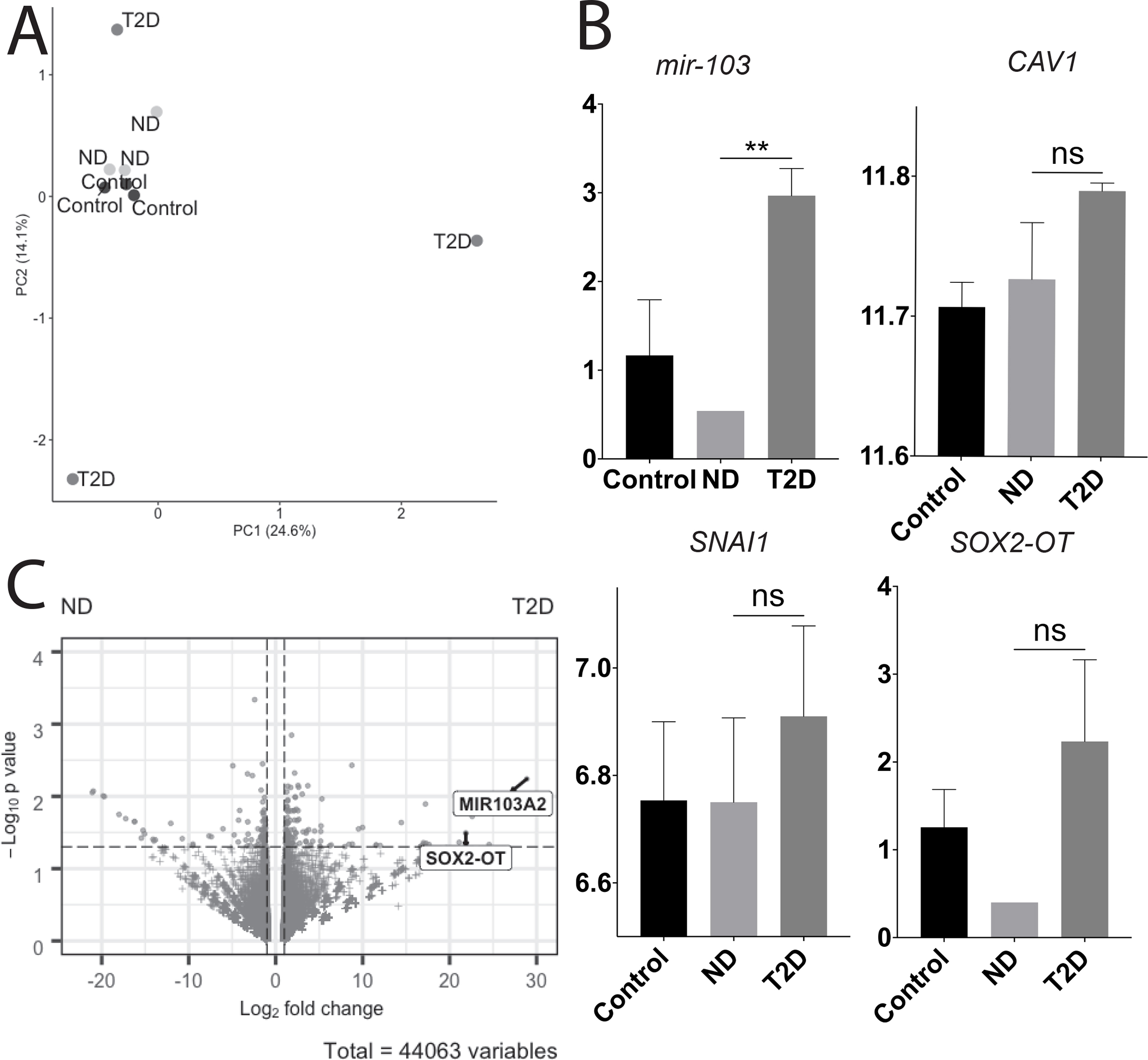 Novel plasma exosome biomarkers for prostate cancer progression in co-morbid metabolic disease