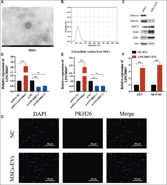 Bone marrow mesenchymal stem cell-derived exosomal LINC00847 inhibits the proliferation, migration, and invasion of Ewing sarcoma.