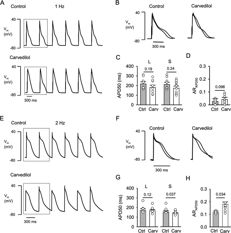 Mechanism of carvedilol induced action potential and calcium alternans.