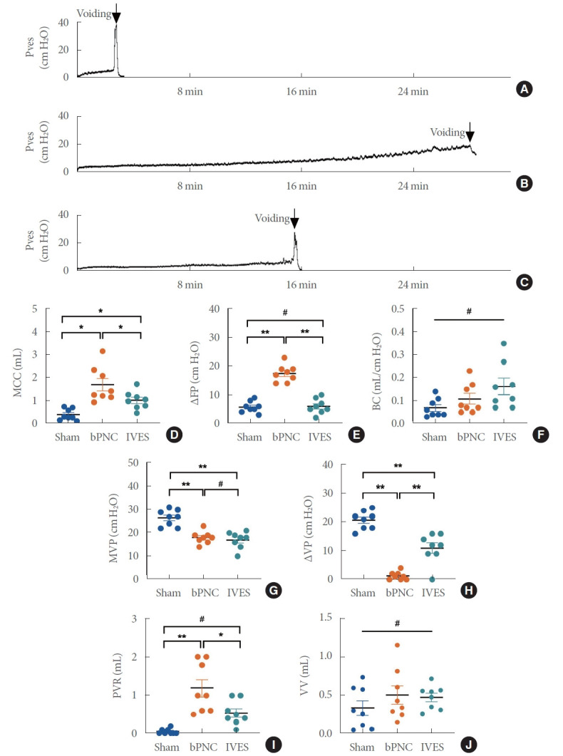 Effects of Intravesical Electrical Stimulation on Urinary Adenosine Triphosphate and Nitric Oxide in Rats With Detrusor Underactivity Induced By Bilateral Pelvic Nerve Crush Injury: The Possible Underlying Mechanism.