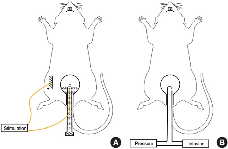 Effects of Intravesical Electrical Stimulation on Urinary Adenosine Triphosphate and Nitric Oxide in Rats With Detrusor Underactivity Induced By Bilateral Pelvic Nerve Crush Injury: The Possible Underlying Mechanism.