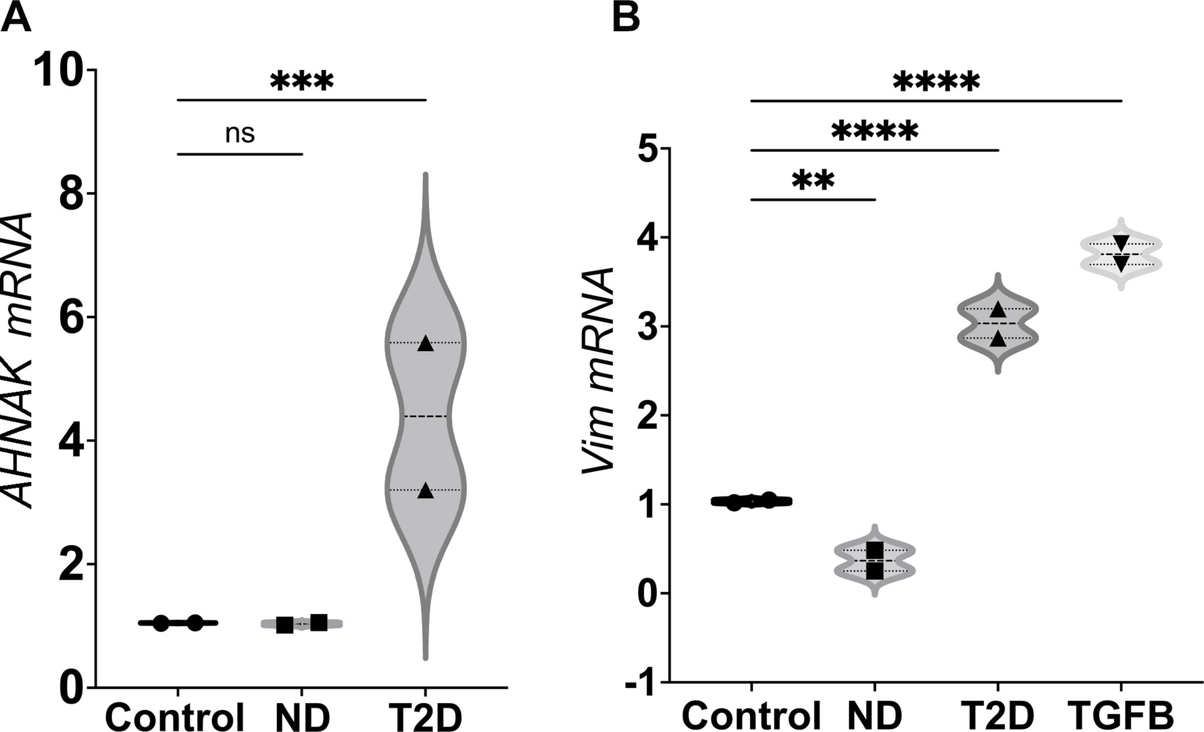 Novel plasma exosome biomarkers for prostate cancer progression in co-morbid metabolic disease