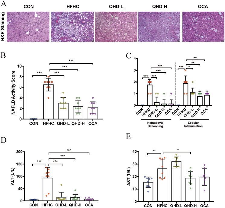 Qushi Huayu decoction attenuated hepatic lipid accumulation via JAK2/STAT3/CPT-1A-related fatty acid β-oxidation in mice with non-alcoholic steatohepatitis.