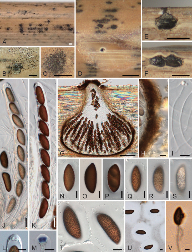 <i>Spirodecosporaceae</i> <i>fam. nov.</i> (<i>Xylariales</i>, <i>Sordariomycetes</i>) and two new species of <i>Spirodecospora</i>.