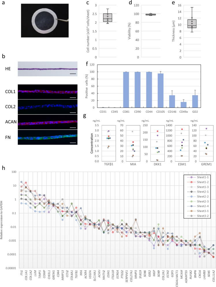 Polydactyly-derived allogeneic chondrocyte cell-sheet transplantation with high tibial osteotomy as regenerative therapy for knee osteoarthritis.