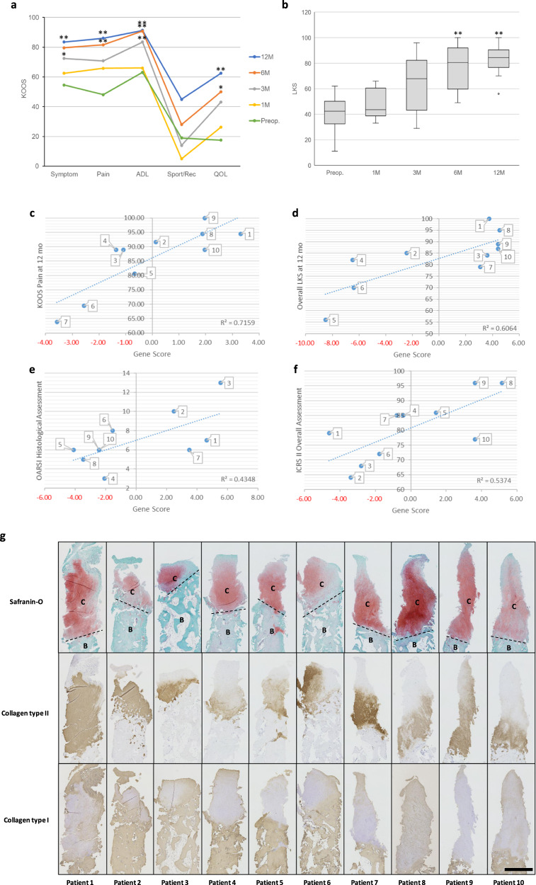 Polydactyly-derived allogeneic chondrocyte cell-sheet transplantation with high tibial osteotomy as regenerative therapy for knee osteoarthritis.