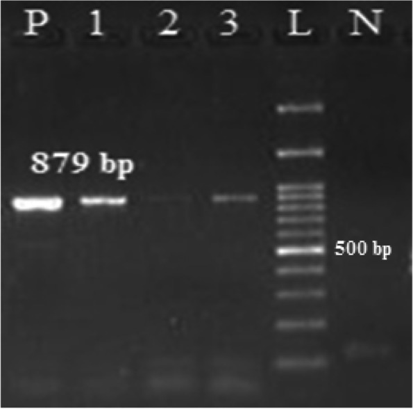 Molecular detection and characterization of Shigella spp. harboring extended-spectrum β-lactamase genes in children with diarrhea in northwest Iran.