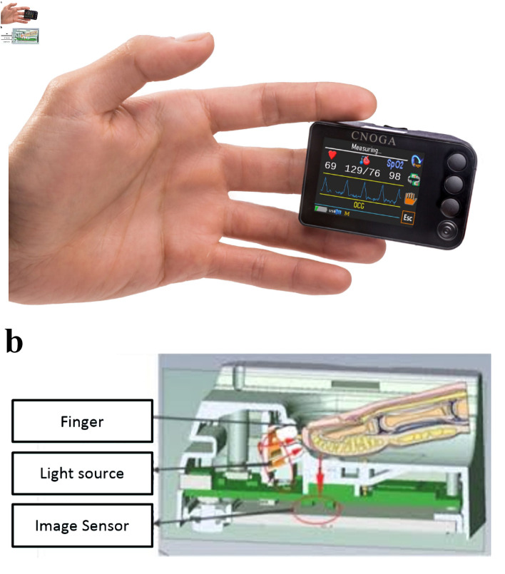 Perioperative Validation of the TensorTip™ MTX Device for Noninvasive Arterial Pressure Measurement: A Method Comparison Study.