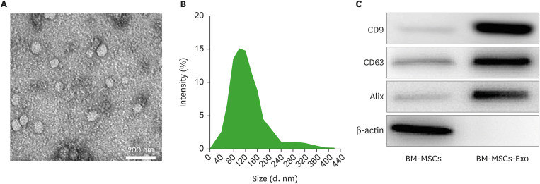 MiR-182-5p Mediated by Exosomes Derived From Bone Marrow Mesenchymal Stem Cell Attenuates Inflammatory Responses by Targeting TLR4 in a Mouse Model of Myocardial Infraction.