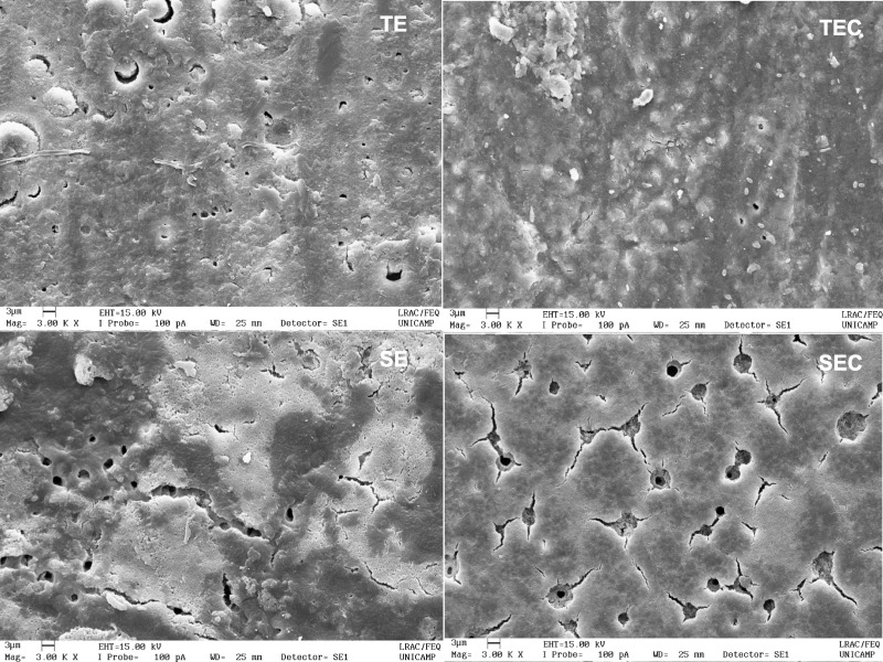 Bonding strategy of a universal adhesive system containing chitosan: influence on dentin permeability, and effect on adhesive layer micromorphology.