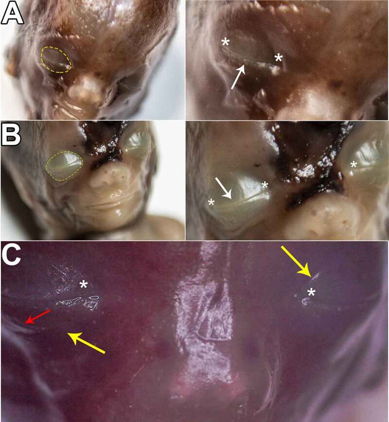 A Systematic Approach of the Intrauterine Morphogenesis of the Human Palpebral Apparatus.