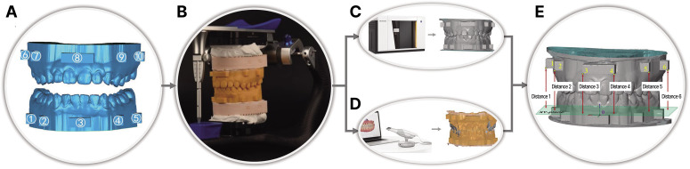 Three-dimensional analysis of the outcome of different scanning strategies in virtual interocclusal registration.