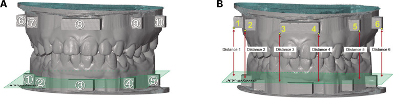 Three-dimensional analysis of the outcome of different scanning strategies in virtual interocclusal registration.