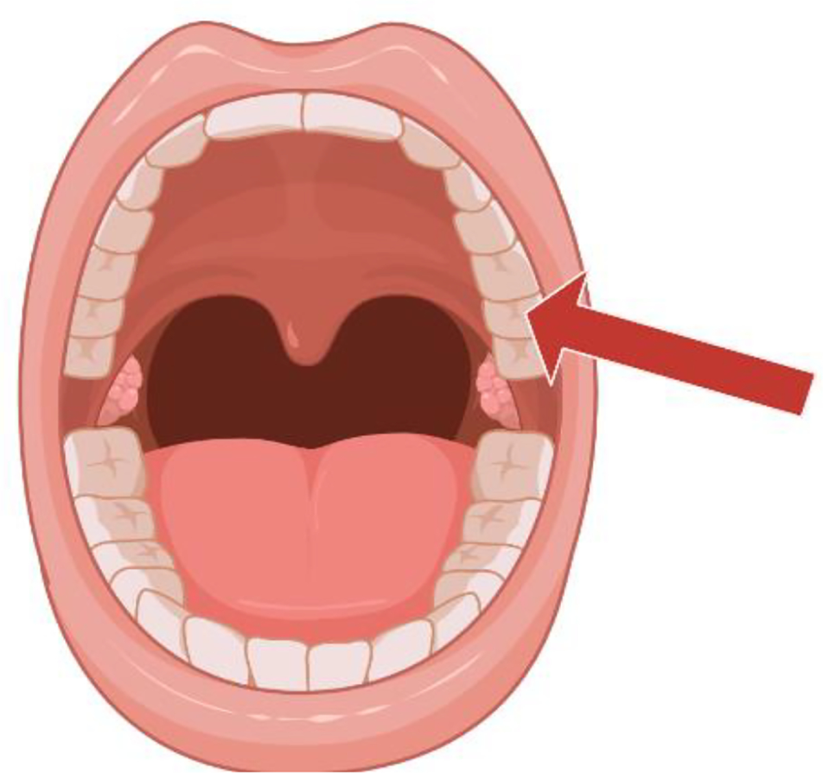 Dental Infections and Risk for Brain Abscess: A Literature Review.