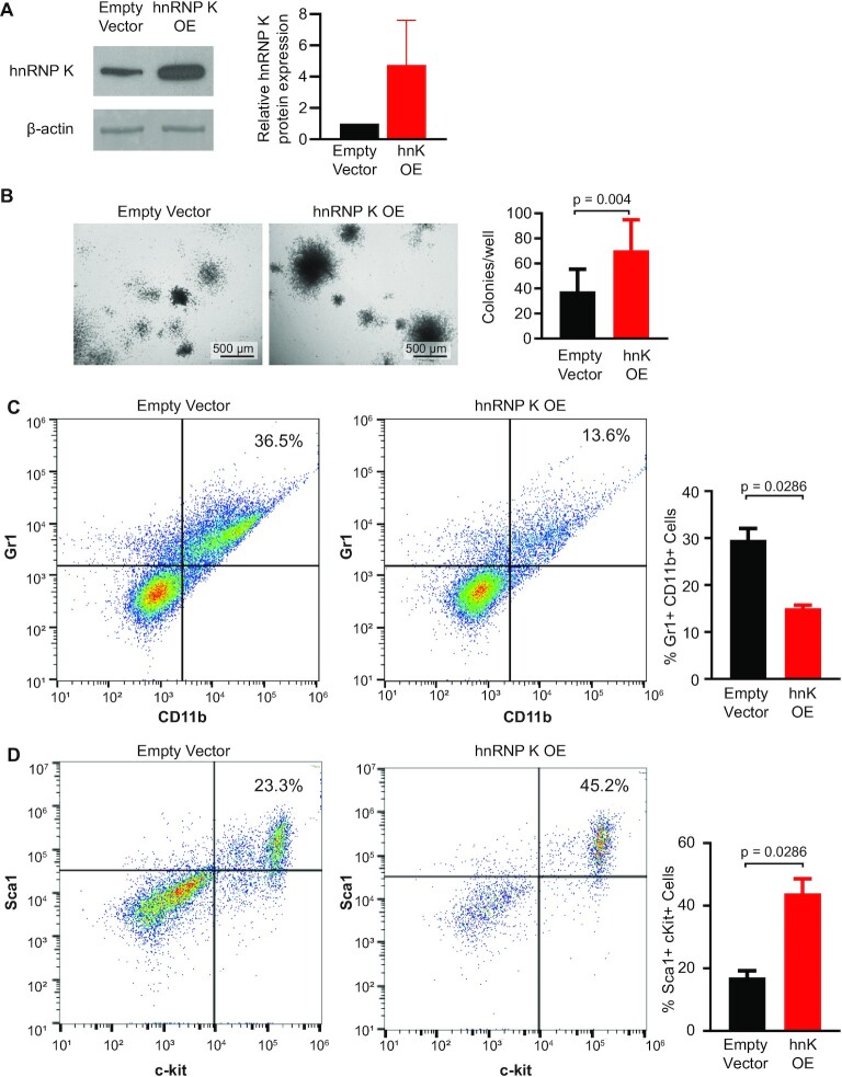 Heterogeneous nuclear ribonucleoprotein K is overexpressed in acute myeloid leukemia and causes myeloproliferation in mice via altered <i>Runx1</i> splicing.