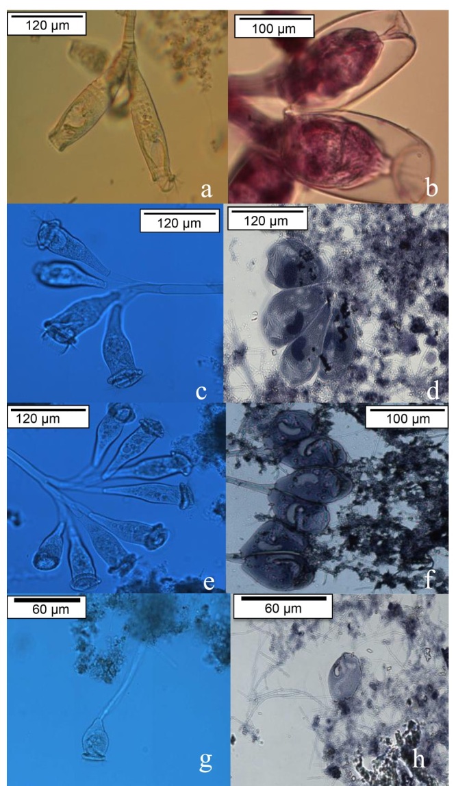 Ciliated Peritrichous Protozoa in a Tezontle-Packed Sequencing Batch Reactor as Potential Indicators of Water Quality.