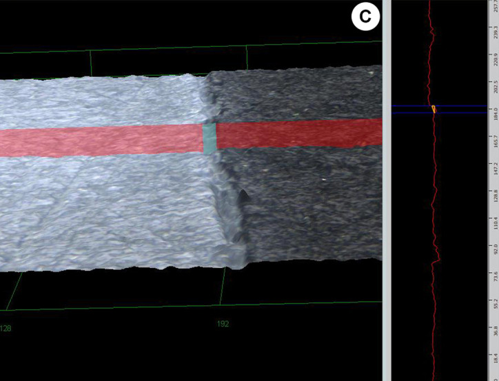 Universal adhesives applied to deep dentin with different bonding treatments.