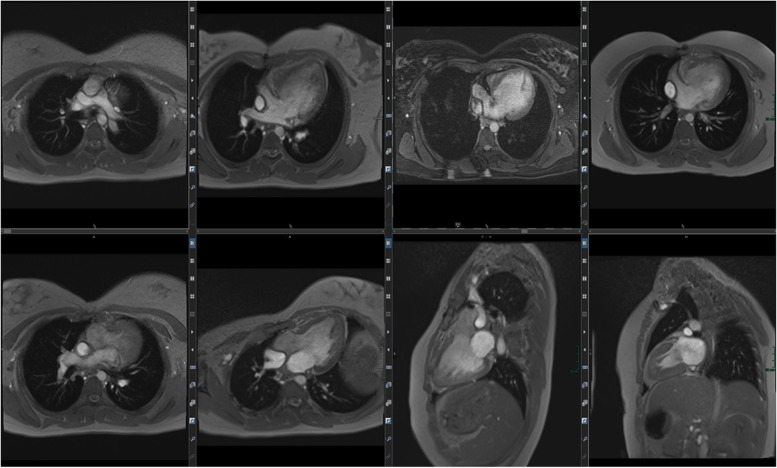 Non-invasive pediatric cardiac imaging-current status and further perspectives.