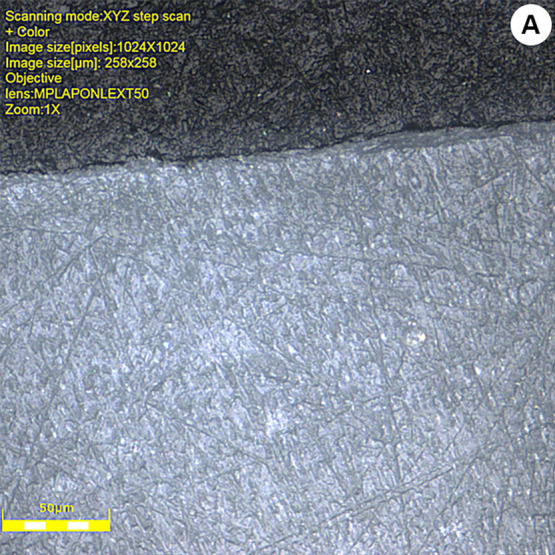 Universal adhesives applied to deep dentin with different bonding treatments.