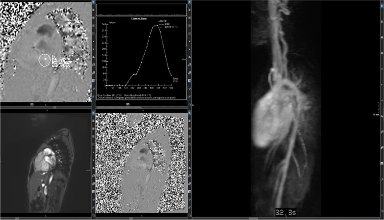 Non-invasive pediatric cardiac imaging-current status and further perspectives.