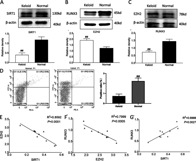 RUNX3 mediates keloid fibroblast proliferation through deacetylation of EZH2 by SIRT1.