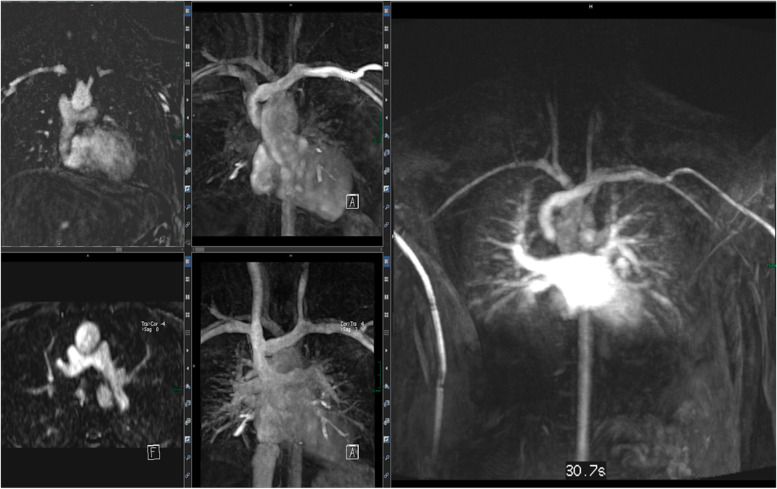 Non-invasive pediatric cardiac imaging-current status and further perspectives.