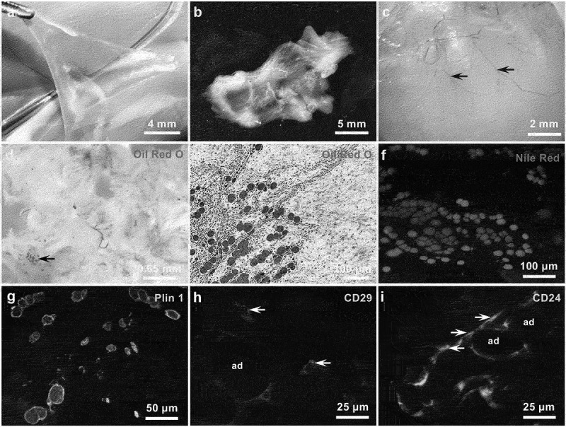 Generation of functional fat organoid from rat superficial fascia.