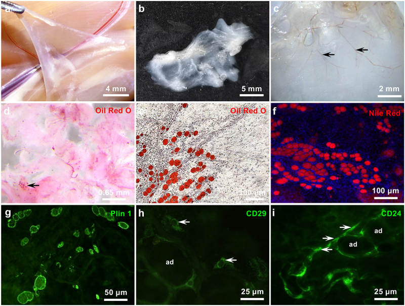 Generation of functional fat organoid from rat superficial fascia.