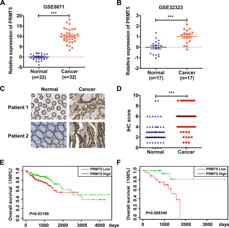 Tadalafil increases the antitumor activity of 5-FU through inhibiting PRMT5-mediated glycolysis and cell proliferation in colorectal cancer.