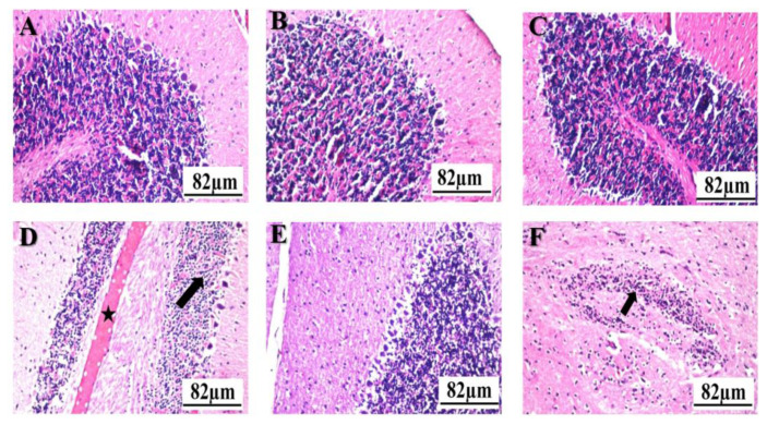 Garlic and allopurinol alleviate the apoptotic pathway in rats' brain following exposure to fipronil insecticide.