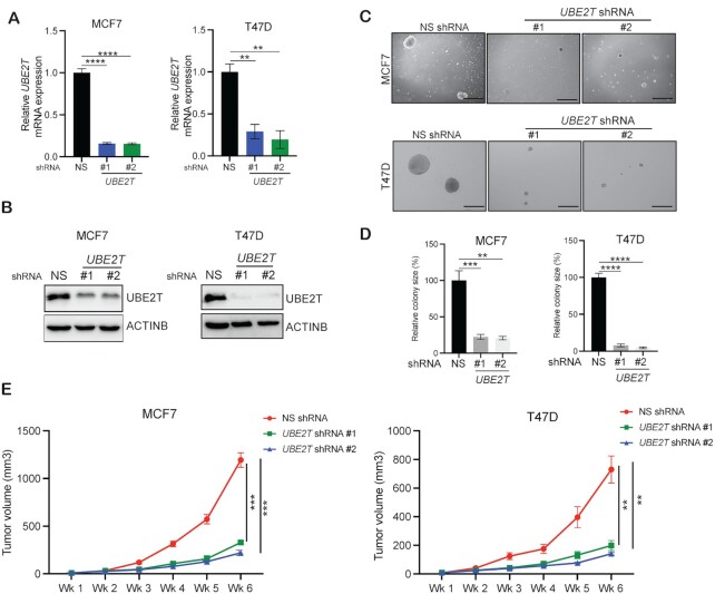 UBE2T promotes breast cancer tumor growth by suppressing DNA replication stress.