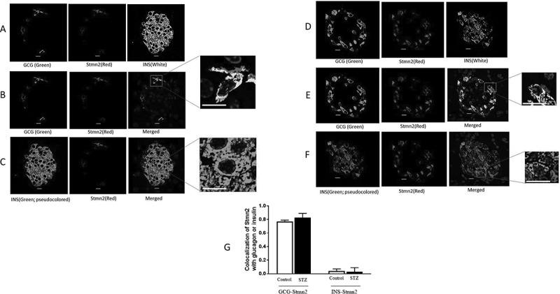 Misrouting of glucagon and stathmin-2 towards lysosomal system of α-cells in glucagon hypersecretion of diabetes.