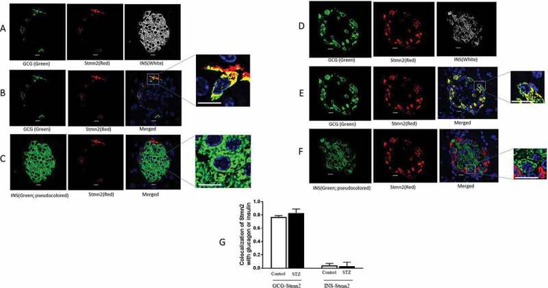 Misrouting of glucagon and stathmin-2 towards lysosomal system of α-cells in glucagon hypersecretion of diabetes.