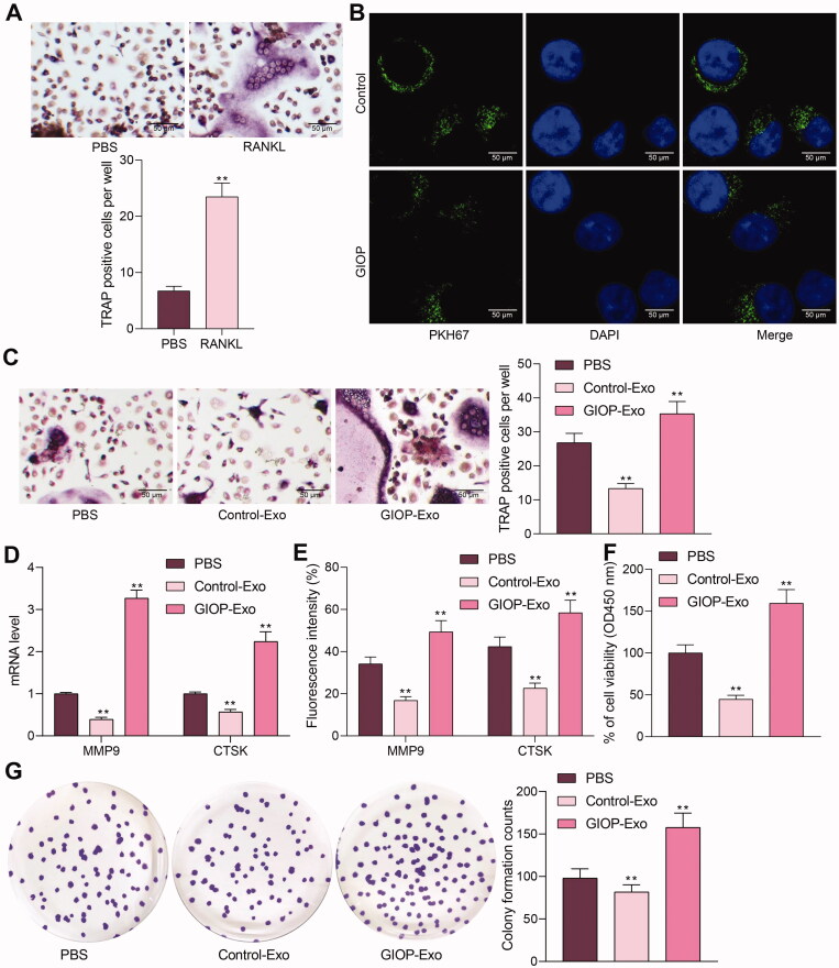 <i>Morinda officinalis</i> polysaccharide enable suppression of osteoclastic differentiation by exosomes derived from rat mesenchymal stem cells.