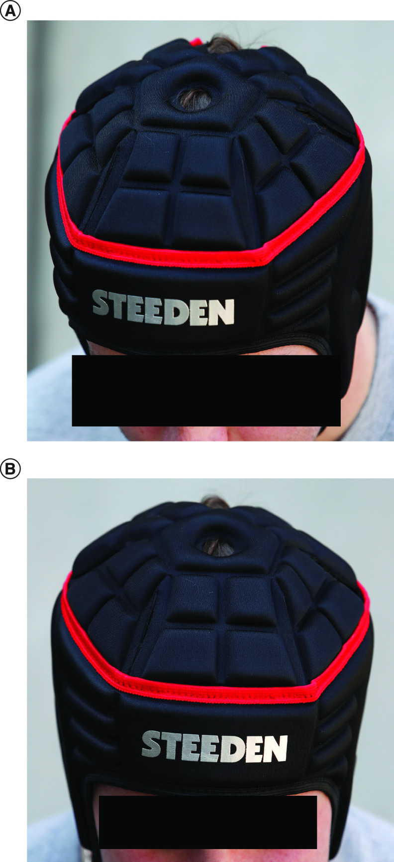 A pilot case crossover study of the use of padded headgear in junior Australian football.