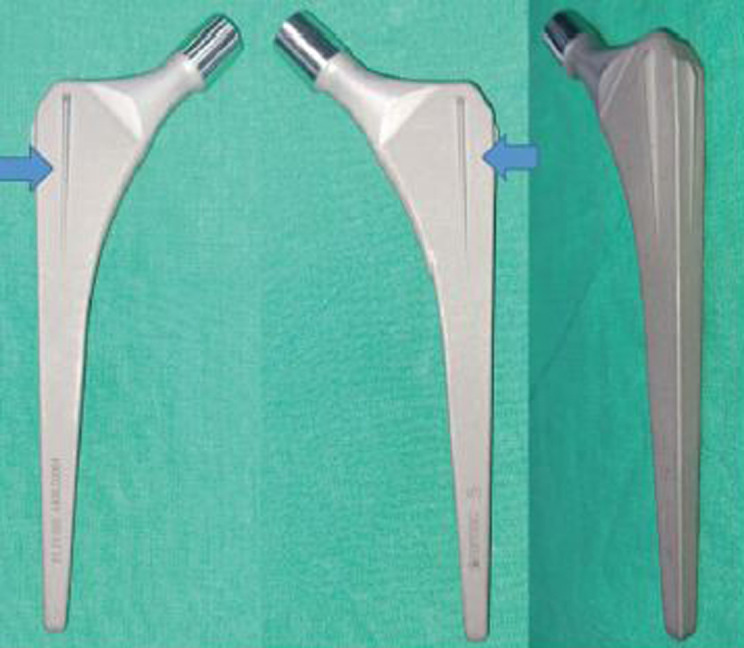 Results of Hip Arthroplasty Using a COREN Stem at a Minimum of Ten Years.