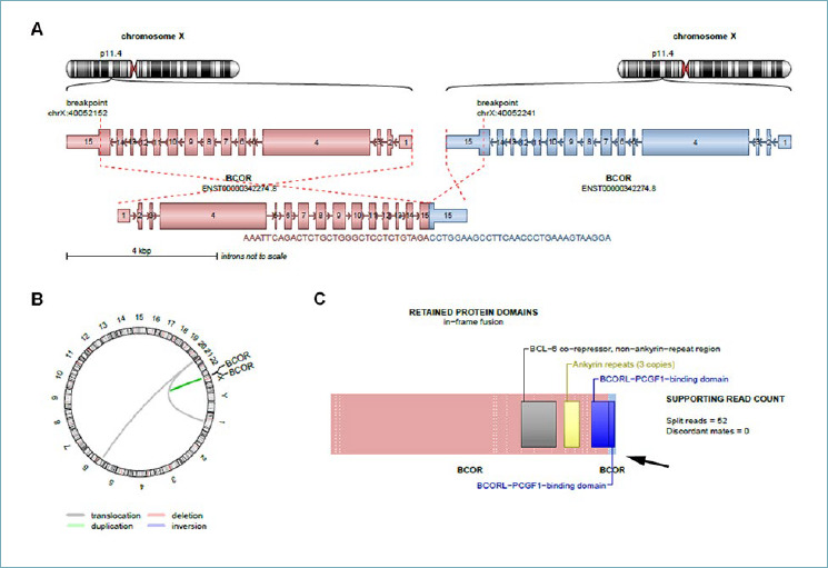 Expanding the spectrum of "mesenchymal" tumors of the central nervous system.