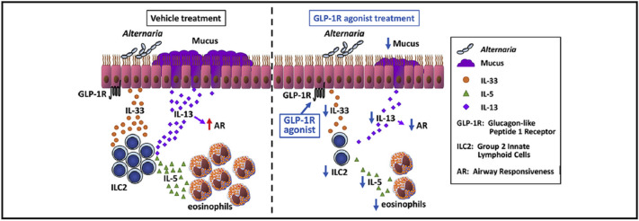 Asthma Exacerbations and Glucagon-Like Peptide-1 Receptor Agonists: a Review of the Current Evidence.