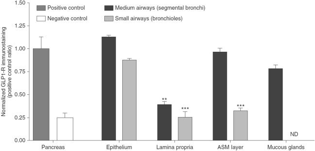 Asthma Exacerbations and Glucagon-Like Peptide-1 Receptor Agonists: a Review of the Current Evidence.