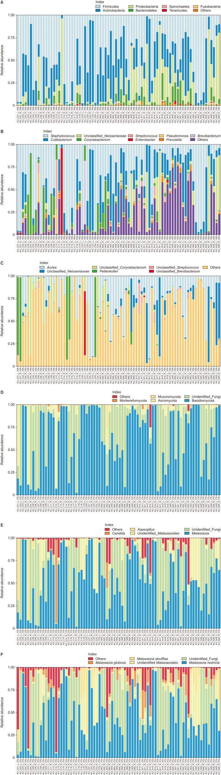 Analysis of the Microbiome of the Ear Canal in Normal Individuals and Patients with Chronic Otitis Externa.