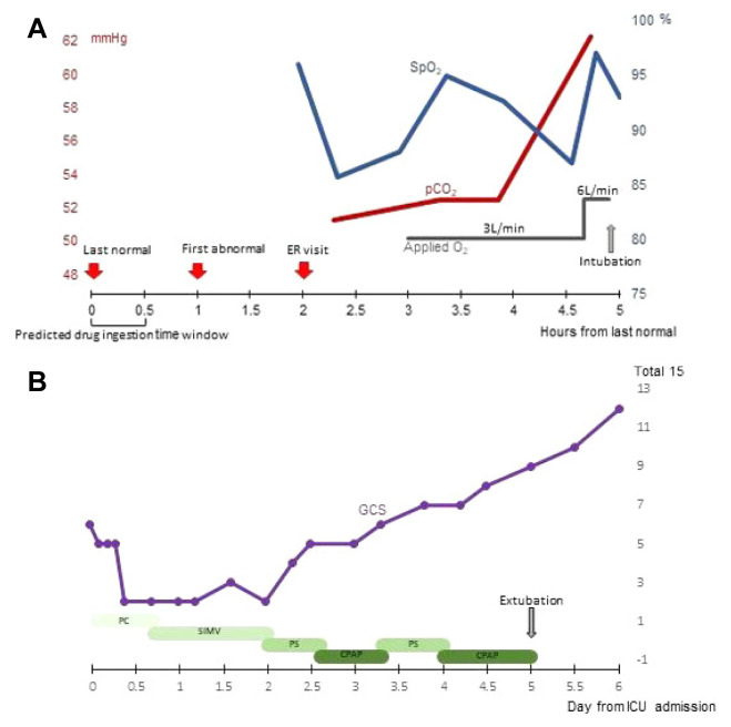 A Case of Perampanel Overdose Presenting with Respiratory Failure.