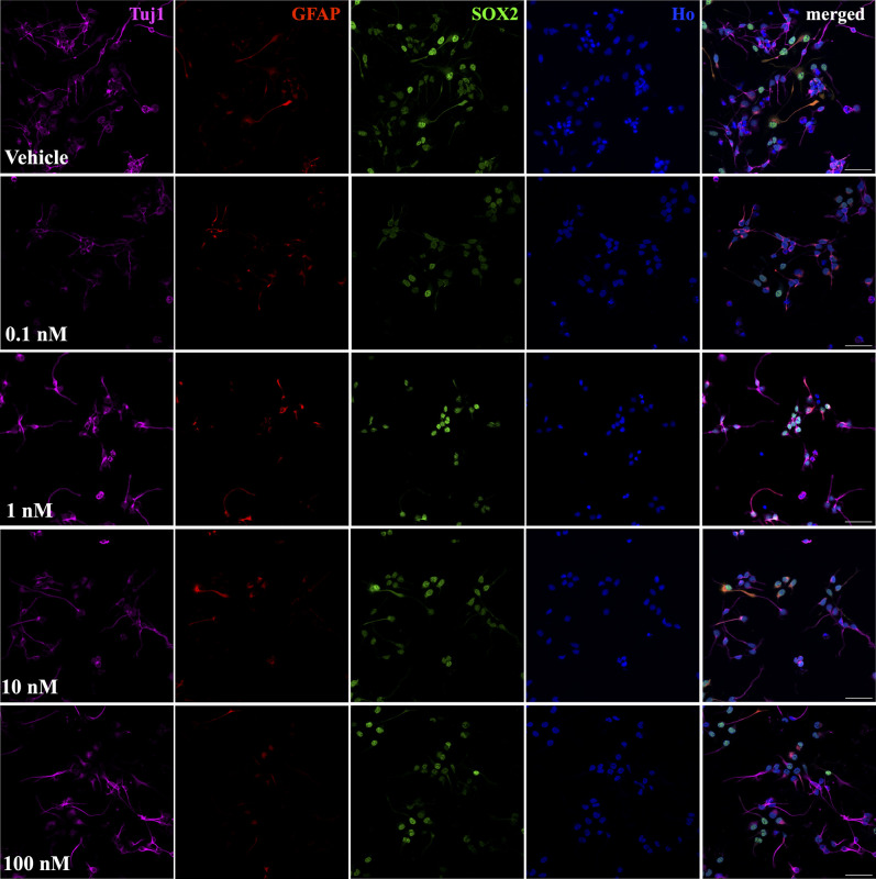 Low Doses of Bisphenol A Disrupt Neuronal Differentiation of Human Neuronal Stem/Progenitor Cells.