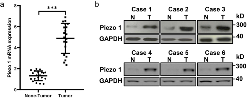 Piezo1 activation facilitates ovarian cancer metastasis via Hippo/YAP signaling axis.