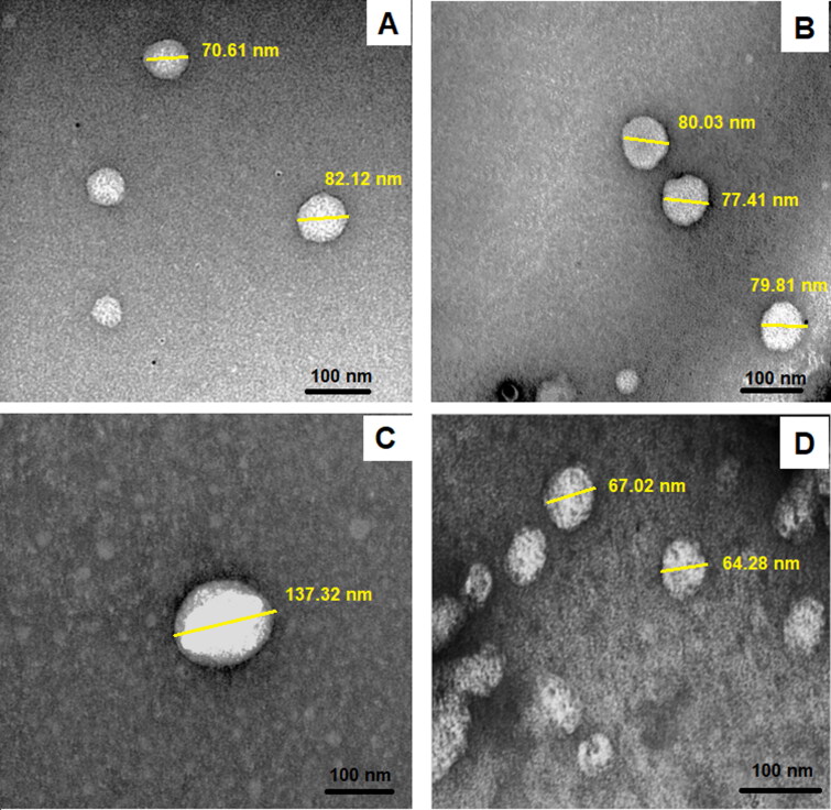 Pitavastatin-loaded bilosomes for oral treatment of hepatocellular carcinoma: a repurposing approach.